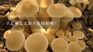 手足癣怎么治才能除根啊?