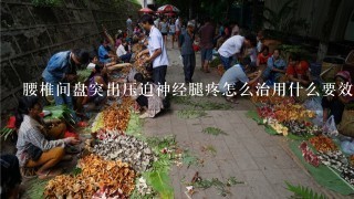 腰椎间盘突出压迫神经腿疼怎么治用什么要效果好？