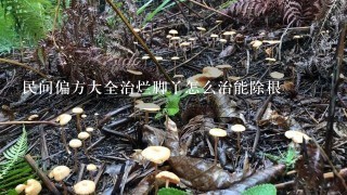 民间偏方大全治烂脚丫怎么治能除根